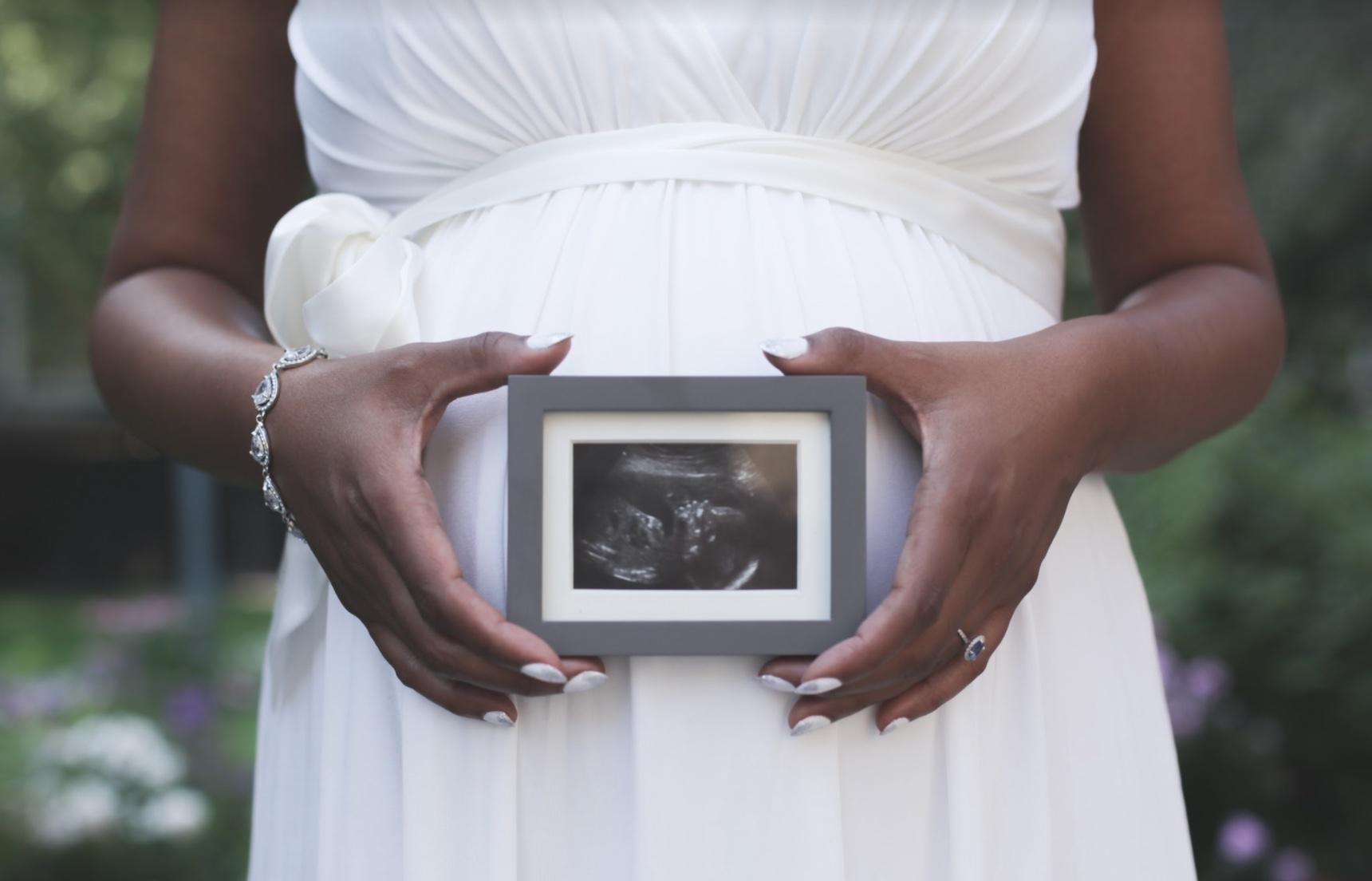 Pregnant woman in a white dress holding a framed ultrasound photograph against her bump